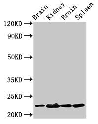 HIST1H1B Antibody - Positive Western Blot detected in Rat brain tissue, Rat kidney tissue, Mouse brain tissue, Mouse spleen tissue. All lanes: HIST1H1B antibody at 1.5 µg/ml Secondary Goat polyclonal to rabbit IgG at 1/50000 dilution. Predicted band size: 23 KDa. Observed band size: 32 KDa