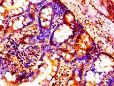 HIST1H1B Antibody - Immunohistochemistry image of paraffin-embedded human small intestine tissue at a dilution of 1:100