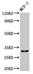 HIST1H1B Antibody - Positive Western Blot detected in MCF-7 whole cell lysate. All lanes: HIST1H1B antibody at 1 µg/ml Secondary Goat polyclonal to rabbit IgG at 1/50000 dilution. Predicted band size: 23 KDa. Observed band size: 32 KDa