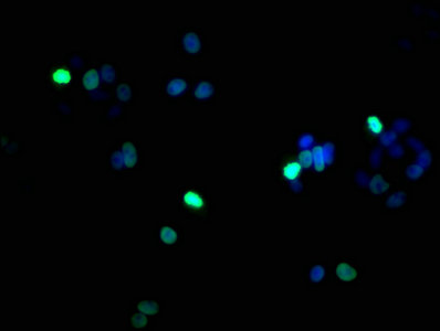 HIST1H1B Antibody - Immunofluorescence staining of HepG2 cells with Phospho-HIST1H1B (S17) Antibody at 1:100, counter-stained with DAPI. The cells were fixed in 4% formaldehyde, permeabilized using 0.2% Triton X-100 and blocked in 10% normal Goat Serum. The cells were then incubated with the antibody overnight at 4°C. The secondary antibody was Alexa Fluor 488-congugated AffiniPure Goat Anti-Rabbit IgG(H+L).