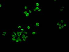 HIST1H1B Antibody - Immunofluorescent analysis of HepG2 cells at a dilution of 1:100 and Alexa Fluor 488-congugated AffiniPure Goat Anti-Rabbit IgG(H+L)