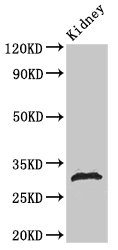 HIST1H1B Antibody - Positive Western Blot detected in Rat kidney tissue. All lanes: HIST1H1B antibody at 1 µg/ml Secondary Goat polyclonal to rabbit IgG at 1/50000 dilution. Predicted band size: 23 KDa. Observed band size: 32 KDa