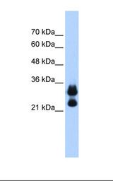 HIST1H1C Antibody - 721_B cell lysate. Anti-HIST1H1C Antibody concentration: 0.25 ug/ml. Gel concentration: 12%.  This image was taken for the unconjugated form of this product. Other forms have not been tested.