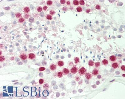 HIST1H1C Antibody - Human Testis: Formalin-Fixed, Paraffin-Embedded (FFPE).  This image was taken for the unconjugated form of this product. Other forms have not been tested.