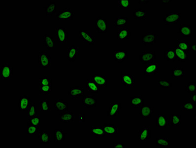 HIST1H1C Antibody - Immunofluorescent analysis of Hela cells (sodium butyrate, 30 mM, 4h) at a dilution of 1:100 and Alexa Fluor 488-congugated AffiniPure Goat Anti-Rabbit IgG(H+L)