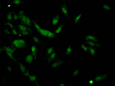 HIST1H1C Antibody - Immunofluorescent analysis of Hela cells at a dilution of 1:100 and Alexa Fluor 488-congugated AffiniPure Goat Anti-Rabbit IgG(H+L)