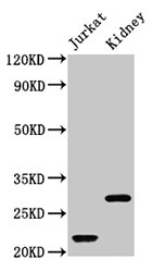 HIST1H1C Antibody - Positive Western Blot detected in Jurkat whole cell lysate, Mouse kidney tissue. All lanes: HIST1H1C antibody at 1 µg/ml Secondary Goat polyclonal to rabbit IgG at 1/50000 dilution. Predicted band size: 22 KDa. Observed band size: 22, 32 KDa