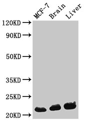 HIST1H1C Antibody - Positive Western Blot detected in MCF-7 whole cell lysate, Mouse brain tissue, Mouse liver tissue. All lanes: HIST1H1C antibody at 0.3 µg/ml Secondary Goat polyclonal to rabbit IgG at 1/50000 dilution. Predicted band size: 22 KDa. Observed band size: 22 KDa