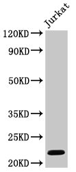 HIST1H1C Antibody - Positive Western Blot detected in Jurkat whole cell lysate. All lanes: HIST1H1C antibody at 1 µg/ml Secondary Goat polyclonal to rabbit IgG at 1/50000 dilution. Predicted band size: 22 KDa. Observed band size: 22 KDa