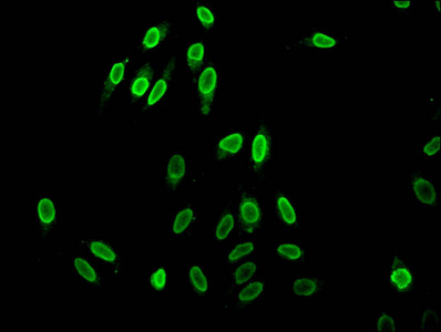 HIST1H1C Antibody - Immunofluorescent analysis of Hela cells (sodium butyrate, 30 mM, 4h) at a dilution of 1:100 and Alexa Fluor 488-congugated AffiniPure Goat Anti-Rabbit IgG(H+L)