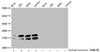HIST1H1C Antibody - Western Blot Detected sample: Hela whole cell lysate, 293 whole cell lysate, K562 whole cell lysate, Jurkat whole cell lysate; Untreated (-) or treated (+) with 30mM sodium butyrate for 4h All lanes: HIST1H1C antibody at 1:2000 Secondary Goat polyclonal to rabbit IgG at 1/40000 dilution Predicted band size: 22 kDa Observed band size: 22 kDa