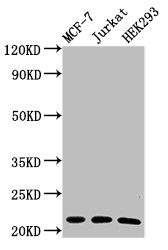 HIST1H1C Antibody - Positive Western Blot detected in MCF-7 whole cell lysate, Jurkat whole cell lysate, HEK293 whole cell lysate. All lanes: HIST1H1C antibody at 0.6 µg/ml Secondary Goat polyclonal to rabbit IgG at 1/50000 dilution. Predicted band size: 22 KDa. Observed band size: 22 KDa