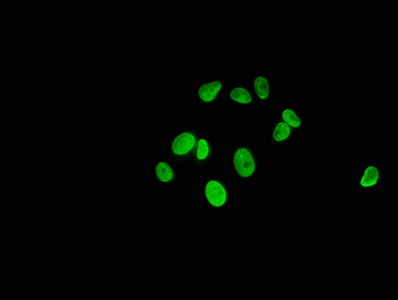 HIST1H1C Antibody - Immunofluorescence staining of MCF-7 cells with Mono-methyl-HIST1H1C (K186) Antibody at 1:5, counter-stained with DAPI. The cells were fixed in 4% formaldehyde, permeabilized using 0.2% Triton X-100 and blocked in 10% normal Goat Serum. The cells were then incubated with the antibody overnight at 4°C. The secondary antibody was Alexa Fluor 488-congugated AffiniPure Goat Anti-Rabbit IgG(H+L).