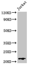 HIST1H1C Antibody - Positive Western Blot detected in Jurkat whole cell lysate. All lanes: HIST1H1C antibody at 1 µg/ml Secondary Goat polyclonal to rabbit IgG at 1/50000 dilution. Predicted band size: 22 KDa. Observed band size: 22 KDa