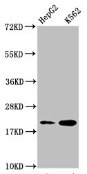 HIST1H1C Antibody - Western Blot Positive WB detected in: HepG2 whole cell lysate, K562 whole cell lysate All lanes: HIST1H1C antibody at 1:500 Secondary Goat polyclonal to rabbit IgG at 1/40000 dilution Predicted band size: 22 kDa Observed band size: 22 kDa
