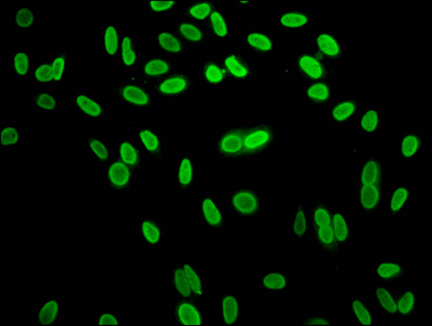 HIST1H1C Antibody - Immunofluorescence staining of Hela cells at a dilution of 1:15, counter-stained with DAPI. The cells were fixed in 4% formaldehyde, permeabilized using 0.2% Triton X-100 and blocked in 10% normal Goat Serum. The cells were then incubated with the antibody overnight at 4 °C.The secondary antibody was Alexa Fluor 488-congugated AffiniPure Goat Anti-Rabbit IgG (H+L) .
