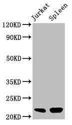 HIST1H1C Antibody - Positive Western Blot detected in Jurkat whole cell lysate, Mouse spleen tissue. All lanes: HIST1H1C antibody at 0.36 µg/ml Secondary Goat polyclonal to rabbit IgG at 1/50000 dilution. Predicted band size: 22 KDa. Observed band size: 22 KDa
