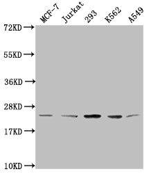 HIST1H1C Antibody - Western Blot Positive WB detected in: MCF-7 whole cell lysate, Jurkat whole cell lysate, 293 whole cell lysate, K562 whole cell lysate, A549 whole cell lysate All lanes: HIST1H1C antibody at 1:2000 Secondary Goat polyclonal to rabbit IgG at 1/40000 dilution Predicted band size: 22 kDa Observed band size: 22 kDa