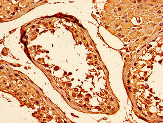 HIST1H1C Antibody - Immunohistochemistry image at a dilution of 1:60 and staining in paraffin-embedded human testis tissue performed on a Leica BondTM system. After dewaxing and hydration, antigen retrieval was mediated by high pressure in a citrate buffer (pH 6.0) . Section was blocked with 10% normal goat serum 30min at RT. Then primary antibody (1% BSA) was incubated at 4 °C overnight. The primary is detected by a biotinylated secondary antibody and visualized using an HRP conjugated SP system.