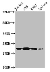 HIST1H1C Antibody - Positive Western Blot detected in Jurkat whole cell lysate, 293 whole cell lysate, K562 whole cell lysate, Mouse spleen tissue. All lanes: HIST1H1C antibody at 0.53 µg/ml Secondary Goat polyclonal to rabbit IgG at 1/50000 dilution. Predicted band size: 22 KDa. Observed band size: 22 KDa