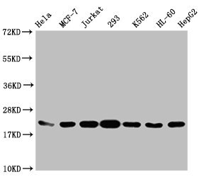 HIST1H1C Antibody - Western Blot Positive WB detected in: Hela whole cell lysate, MCF-7 whole cell lysate, Jurkat whole cell lysate, 293 whole cell lysate, K562 whole cell lysate, HL-60 whole cell lysate, HepG2 whole cell lysate All lanes: HIST1H1C antibody at 1:1000 Secondary Goat polyclonal to rabbit IgG at 1/40000 dilution Predicted band size: 22 kDa Observed band size: 22 kDa