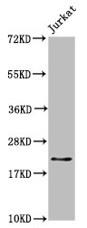 HIST1H1C Antibody - Positive Western Blot detected in Jurkat whole cell lysate. All lanes: HIST1H1C antibody at 1.7 µg/ml Secondary Goat polyclonal to rabbit IgG at 1/50000 dilution. Predicted band size: 22 KDa. Observed band size: 22 KDa