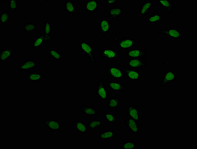 HIST1H1C Antibody - Immunofluorescence staining of hela at a dilution of 1:20, counter-stained with DAPI. The cells were fixed in 4% formaldehyde, permeabilized using 0.2% Triton X-100 and blocked in 10% normal Goat Serum. The cells were then incubated with the antibody overnight at 4 °C.The secondary antibody was Alexa Fluor 488-congugated AffiniPure Goat Anti-Rabbit IgG (H+L) .