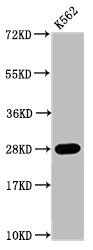 HIST1H1C Antibody - Positive Western Blot detected in K562 whole cell lysate(all treated by 30mM sodium butyrate for 4h). All lanes: HIST1H1C antibody at 0.64 µg/ml Secondary Goat polyclonal to rabbit IgG at 1/50000 dilution. Predicted band size: 22 KDa. Observed band size: 28 KDa