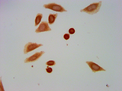 HIST1H1C Antibody - Immunocytochemistry analysis of Formyl-HIST1H1C (K109) Antibody diluted at 1:20 and staining in Hela cells (treated with 30mM sodium butyrate for 4h) performed on a Leica BondTM system. The cells were fixed in 4% formaldehyde, permeabilized using 0.2% Triton X-100 and blocked with 10% normal goat serum 30min at RT. Then primary antibody (1% BSA) was incubated at 4°C overnight. The primary is detected by a biotinylated secondary antibody and visualized using an HRP conjugated SP system.
