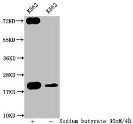 HIST1H1C Antibody - Western Blot Detected sample: K562 whole cell lysate; Untreated (-) or treated (+) with 30mM sodium butyrate for 4h All lanes: HIST1H1C antibody at 1:400 Secondary Goat polyclonal to rabbit IgG at 1/50000 dilution Predicted band size: 22 kDa Observed band size: 22 kDa