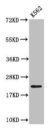HIST1H1C Antibody - Western Blot Positive WB detected in: K562 whole cell lysate All lanes: HIST1H1C antibody at 0.48µg/ml Secondary Goat polyclonal to rabbit IgG at 1/50000 dilution Predicted band size: 22 kDa Observed band size: 22 kDa
