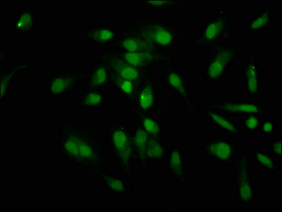HIST1H1C Antibody - Immunofluorescence staining of hela at a dilution of 1:12.5, counter-stained with DAPI. The cells were fixed in 4% formaldehyde, permeabilized using 0.2% Triton X-100 and blocked in 10% normal Goat Serum. The cells were then incubated with the antibody overnight at 4°C.The secondary antibody was Alexa Fluor 488-congugated AffiniPure Goat Anti-Rabbit IgG (H+L) .
