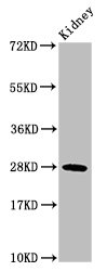 HIST1H1C Antibody - Positive Western Blot detected in Rat kidney tissue. All lanes: HIST1H1C antibody at 0.776 µg/ml Secondary Goat polyclonal to rabbit IgG at 1/50000 dilution. Predicted band size: 22 KDa. Observed band size: 22 KDa