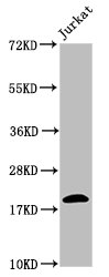 HIST1H1C Antibody - Positive Western Blot detected in Jurkat whole cell lysate(all treated by 30mM sodium butyrate for 4h). All lanes: HIST1H1C antibody at 2.2 µg/ml Secondary Goat polyclonal to rabbit IgG at 1/50000 dilution. Predicted band size: 22 KDa. Observed band size: 22 KDa