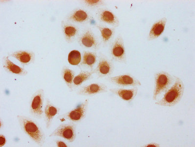 HIST1H1C Antibody - Immunocytochemistry analysis diluted at 1:5 and staining in Hela cells(treated with 30mM sodium butyrate for 4h) performed on a Leica BondTM system. The cells were fixed in 4% formaldehyde, permeabilized using 0.2% Triton X-100 and blocked with 10% normal Goat serum 30min at RT. Then primary antibody (1% BSA) was incubated at 4°C overnight. The primary is detected by a biotinylated Secondary antibody and visualized using an HRP conjugated SP system.