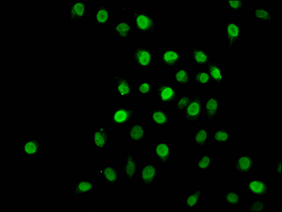 HIST1H1C Antibody - Immunofluorescence staining of Hela cells (treated with 30mM sodium butyrate for 4h) diluted at 1:2.5, counter-stained with DAPI. The cells were fixed in 4% formaldehyde, permeabilized using 0.2% Triton X-100 and blocked in 10% normal Goat Serum. The cells were then incubated with the antibody overnight at 4°C.The Secondary antibody was Alexa Fluor 488-congugated AffiniPure Goat Anti-Rabbit IgG (H+L) .