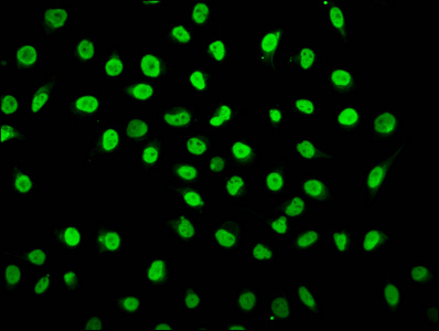 HIST1H1C Antibody - Immunofluorescence staining of Hela cells (treated with 30mM sodium butyrate for 4h) diluted at 1:5, counter-stained with DAPI. The cells were fixed in 4% formaldehyde, permeabilized using 0.2% Triton X-100 and blocked in 10% normal Goat Serum. The cells were then incubated with the antibody overnight at 4°C.The Secondary antibody was Alexa Fluor 488-congugated AffiniPure Goat Anti-Rabbit IgG (H+L) .