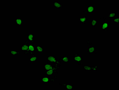 HIST1H1C Antibody - Immunofluorescent analysis of Hela cells (treated with 30mM crotonylate for 4h) diluted at 1:100 and Alexa Fluor 488-congugated AffiniPure Goat Anti-Rabbit IgG(H+L)