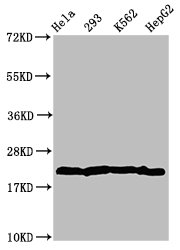 HIST1H1C Antibody - Western Blot Positive WB detected in: Hela whole cell lysate, 293 whole cell lysate, K562 whole cell lysate, HepG2 whole cell lysate All Lanes: HIST1H1C antibody at 2.8µg/ml Secondary Goat polyclonal to rabbit IgG at 1/50000 dilution Predicted band size: 22 KDa Observed band size: 22 KDa