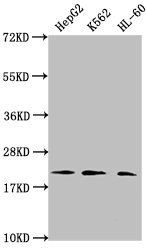 HIST1H1C Antibody - Western Blot Positive WB detected in: HepG2 whole cell lysate, K562 whole cell lysate, HL-60 whole cell lysate All lanes: HIST1H1C antibody at 1:2000 Secondary Goat polyclonal to rabbit IgG at 1/40000 dilution Predicted band size: 22 kDa Observed band size: 22 kDa