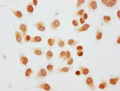 HIST1H1C Antibody - Immunocytochemistry analysis of Di-methyl-HIST1H1C (K45) Antibody diluted at 1:10 and staining in Hela cells performed on a Leica BondTM system. The cells were fixed in 4% formaldehyde, permeabilized using 0.2% Triton X-100 and blocked with 10% normal goat serum 30min at RT. Then primary antibody (1% BSA) was incubated at 4°C overnight. The primary is detected by a biotinylated secondary antibody and visualized using an HRP conjugated SP system.