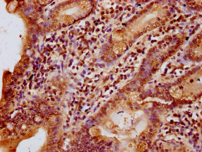 HIST1H1C Antibody - Immunohistochemistry Dilution at 1:10 and staining in paraffin-embedded human small intestine tissue performed on a Leica BondTM system. After dewaxing and hydration, antigen retrieval was mediated by high pressure in a citrate buffer (pH 6.0). Section was blocked with 10% normal Goat serum 30min at RT. Then primary antibody (1% BSA) was incubated at 4°C overnight. The primary is detected by a biotinylated Secondary antibody and visualized using an HRP conjugated SP system.