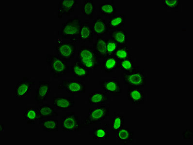 HIST1H1C Antibody - Immunofluorescence staining of A549 cells with HIST1H1C (Ab-25) Antibody, counter-stained with DAPI. The cells were fixed in 4% formaldehyde, permeabilized using 0.2% Triton X-100 and blocked in 10% normal Goat Serum. The cells were then incubated with the antibody overnight at 4°C. The secondary antibody was Alexa Fluor 488-congugated AffiniPure Goat Anti-Rabbit IgG(H+L).