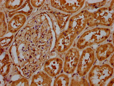 HIST1H1C Antibody - Immunohistochemistry Dilution at 1:20 and staining in paraffin-embedded human kidney tissue performed on a Leica BondTM system. After dewaxing and hydration, antigen retrieval was mediated by high pressure in a citrate buffer (pH 6.0). Section was blocked with 10% normal Goat serum 30min at RT. Then primary antibody (1% BSA) was incubated at 4°C overnight. The primary is detected by a biotinylated Secondary antibody and visualized using an HRP conjugated SP system.