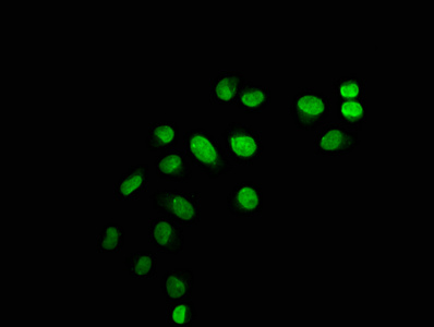 HIST1H1C Antibody - Immunofluorescence staining of Hela cells with Mono-methyl-HIST1H1C (K45) Antibody at 1:12.5, counter-stained with DAPI. The cells were fixed in 4% formaldehyde, permeabilized using 0.2% Triton X-100 and blocked in 10% normal Goat Serum. The cells were then incubated with the antibody overnight at 4°C. The secondary antibody was Alexa Fluor 488-congugated AffiniPure Goat Anti-Rabbit IgG(H+L).