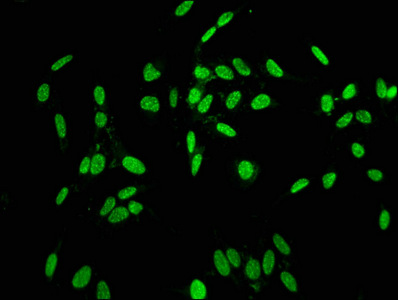 HIST1H1C Antibody - Immunofluorescence staining of Hela cells at a dilution of 1:5, counter-stained with DAPI. The cells were fixed in 4% formaldehyde, permeabilized using 0.2% Triton X-100 and blocked in 10% normal Goat Serum. The cells were then incubated with the antibody overnight at 4 °C.The secondary antibody was Alexa Fluor 488-congugated AffiniPure Goat Anti-Rabbit IgG (H+L) .