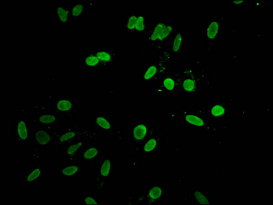 HIST1H1D Antibody - Immunofluorescent analysis of Hela cells at a dilution of 1:100 and Alexa Fluor 488-congugated AffiniPure Goat Anti-Rabbit IgG(H+L)