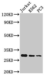 HIST1H1D Antibody - Positive Western Blot detected in Jurkat whole cell lysate, K562 whole cell lysate, PC3 whole cell lysate. All lanes: HIST1H1D antibody at 1.5 µg/ml Secondary Goat polyclonal to rabbit IgG at 1/50000 dilution. Predicted band size: 23 KDa. Observed band size: 32 KDa