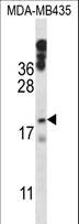 HIST1H1E Antibody - HIST1H1E Antibody western blot of MDA-MB435 cell line lysates (35 ug/lane). The HIST1H1E antibody detected the HIST1H1E protein (arrow).