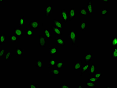 HIST1H1E Antibody - Immunofluorescent analysis of Hela cells (sodium butyrate, 30 mM, 4h) at a dilution of 1:100 and Alexa Fluor 488-congugated AffiniPure Goat Anti-Rabbit IgG(H+L)